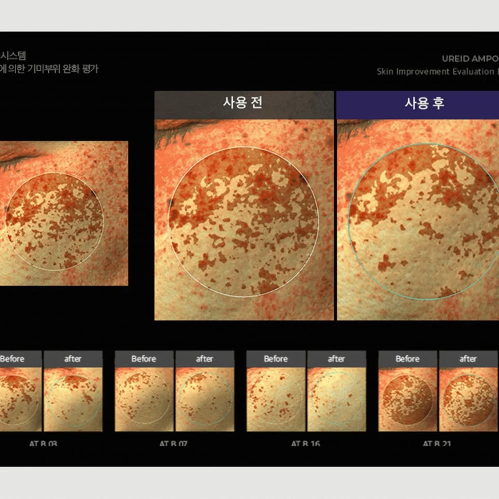 비에논 우레이드 기미앰플 검버섯 흑자 나이아신아마이드 미백앰플 상세 이미지 4